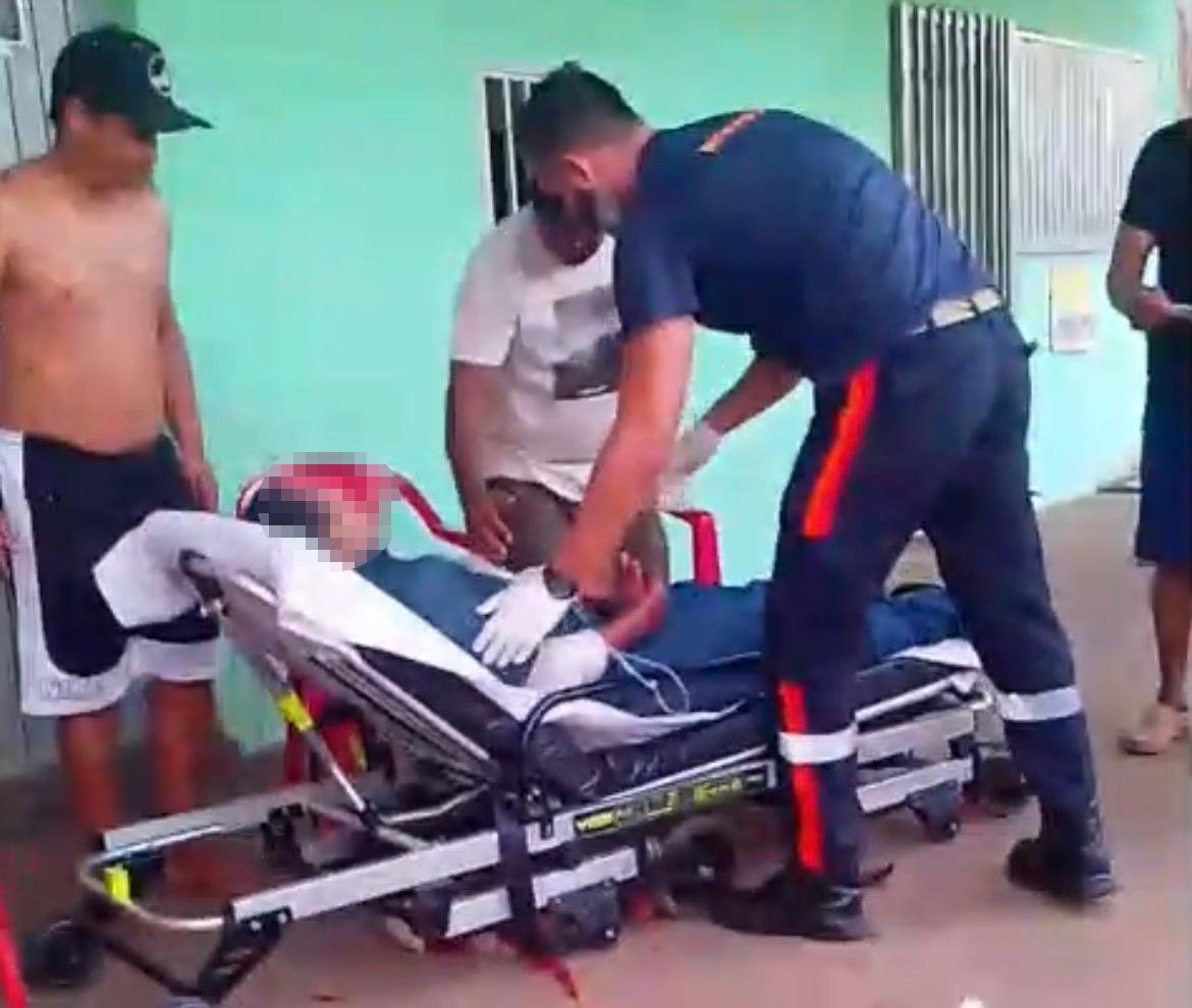 Em Três Lagoas: Homem utiliza os braços para se proteger de linha com cerol e é gravemente ferido